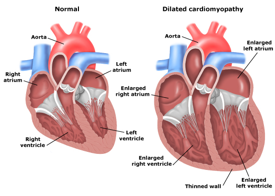 Enlarged Liver Signs And Symptoms Make Health Easy Pictures Wallpapers