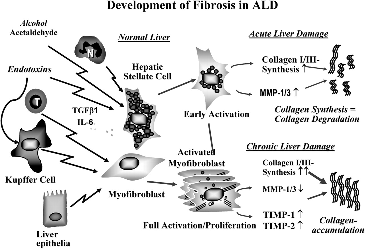 Figure 3 Alcoholic Liver Disease Pathogenesis And New Targets Pictures Wallpapers