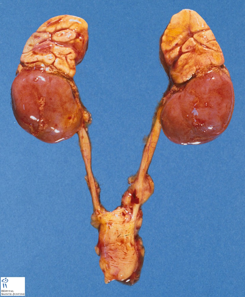 Liver Disease And Metabolic Syndrome Pictures Wallpapers