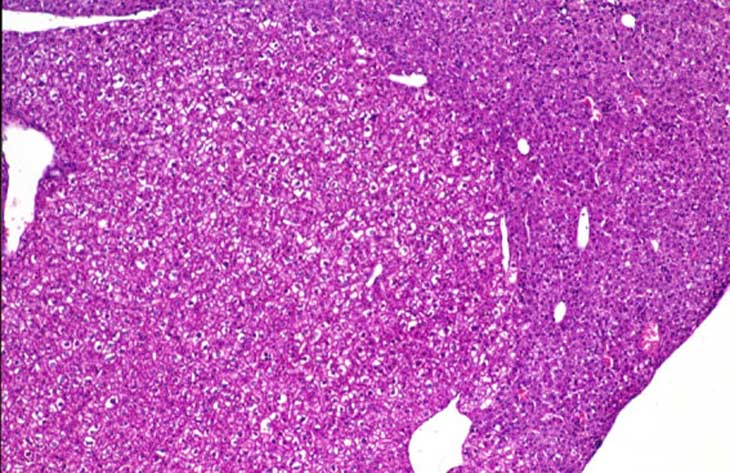 Unique Liver Lesions Of Genetically Altered Mice Pictures Wallpapers