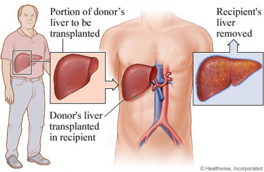 Where Is The Liver Located Pictures Wallpapers