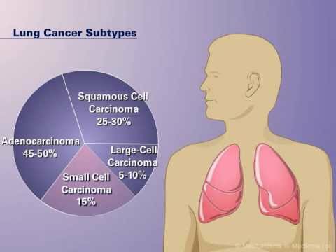 The Pathophysiology of Non small Cell Lung Cancer 118283