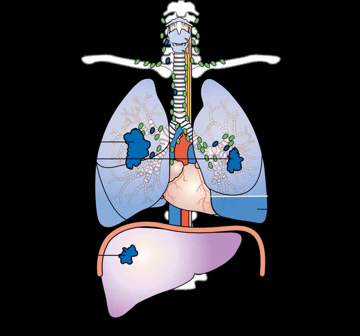 cough chest pain and wheezing read more to learn «