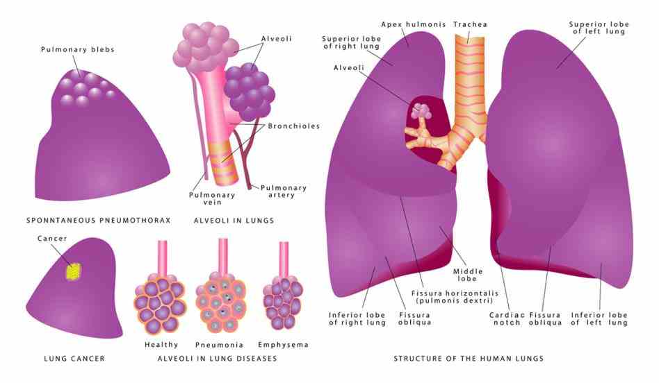 Cancer Of The Lungs Symptoms Pictures Wallpapers