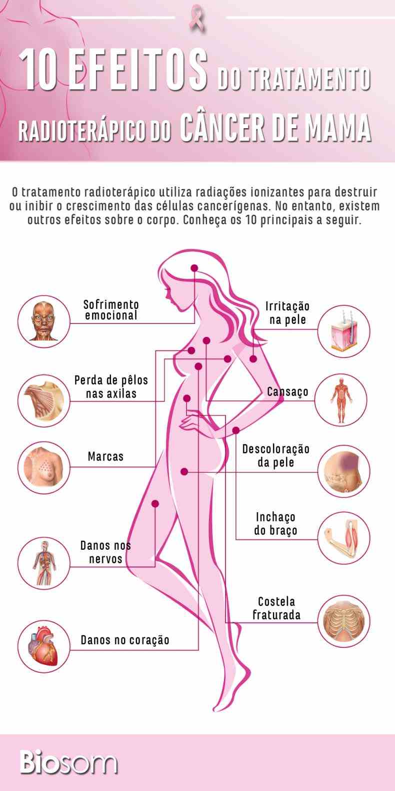 signos a veces no manifiestan  las Cancer Sintomas mujeres