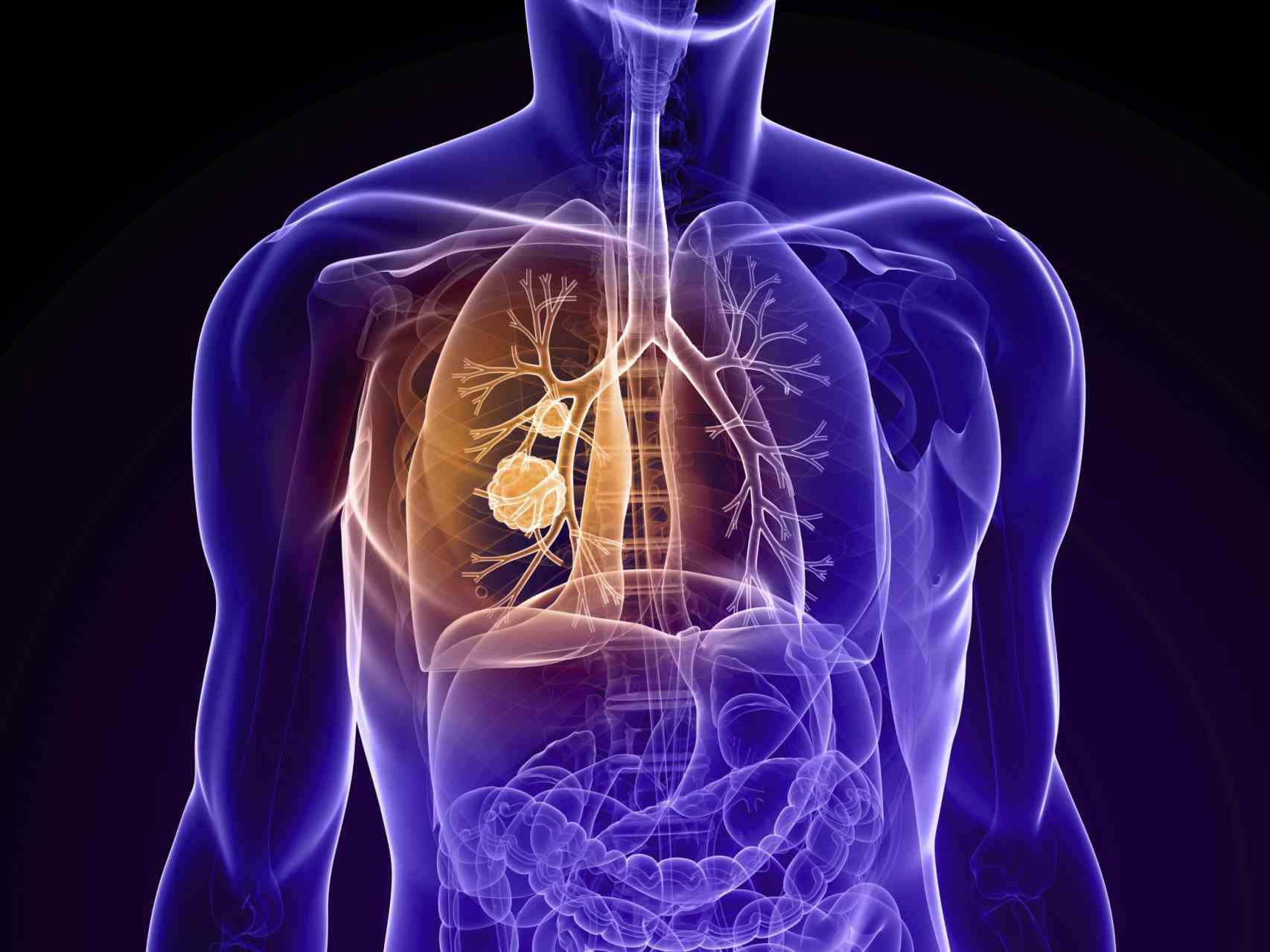 the Cancer Of The Lungs Symptoms early stages