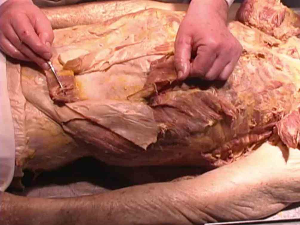 Labeled Abdominal Gross Anatomy Pictures Pictures Wallpapers