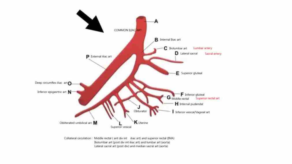 The Anatomy Of Internal Iliac Artery Internal Iliac Artery