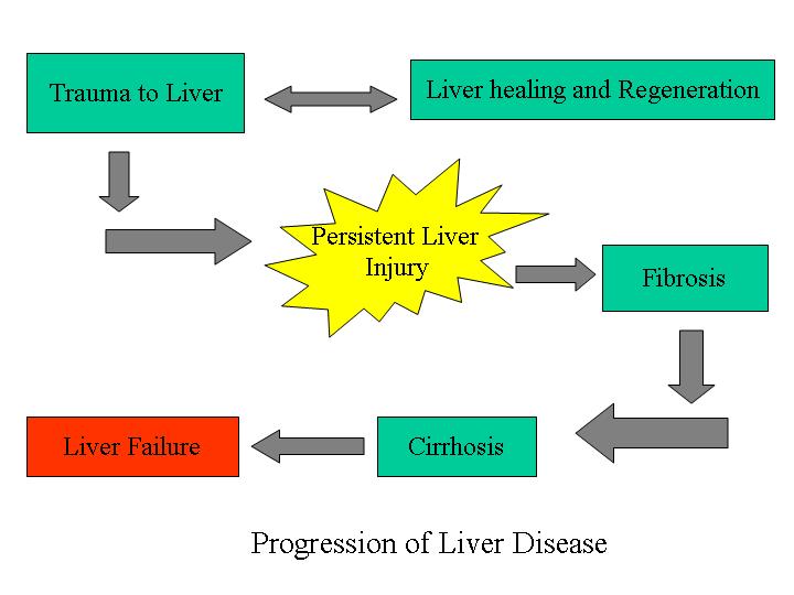 8 Most Causes Of Liver Damage Are Pictures Wallpapers