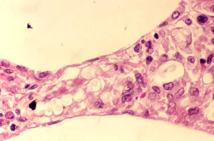 Details Public Health Image Library Phil Pictures Wallpapers