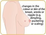 Breast Cancer Stages And Symptoms Pictures Wallpapers