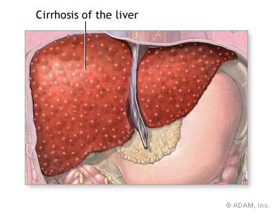 Liver Count High Symptoms Pictures Wallpapers