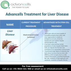 Treatment For Liver Disease Using Stem Cells Liver Cirrhosis Therapy Pictures Wallpapers