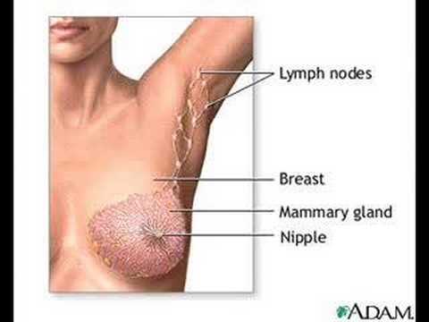 What Are The Signs Of Breast Cancer Pictures Wallpapers