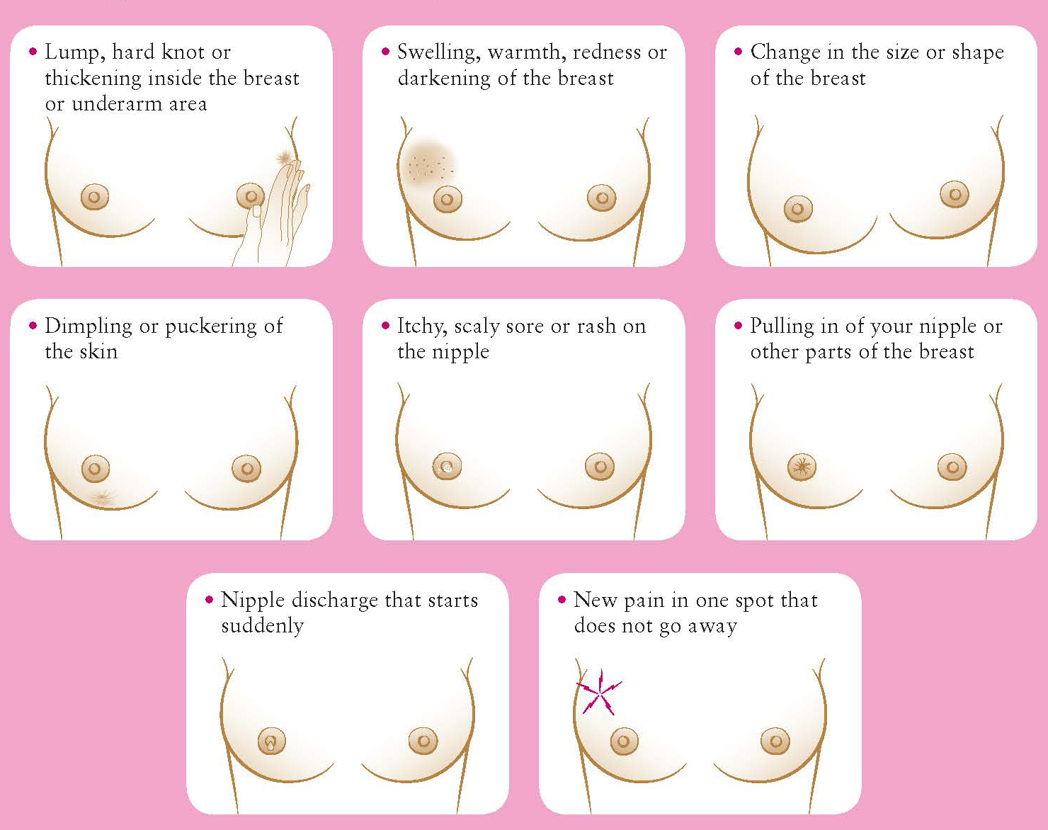 Benign Conditions Of The Breast