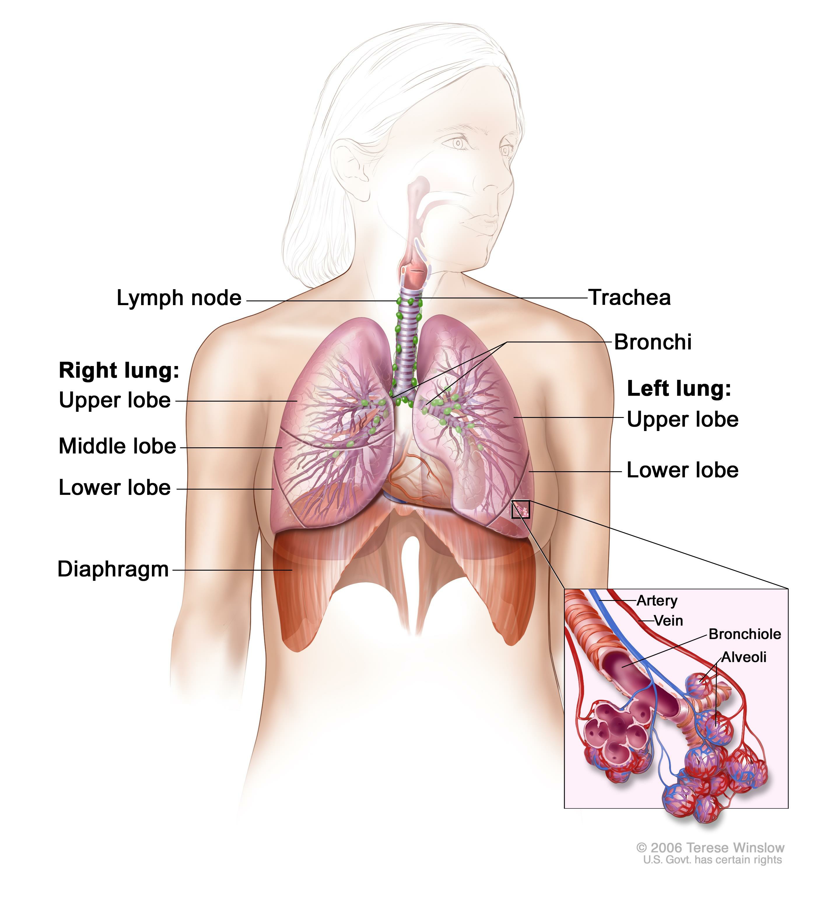 Small Cell Lung Cancer Treatment 177723