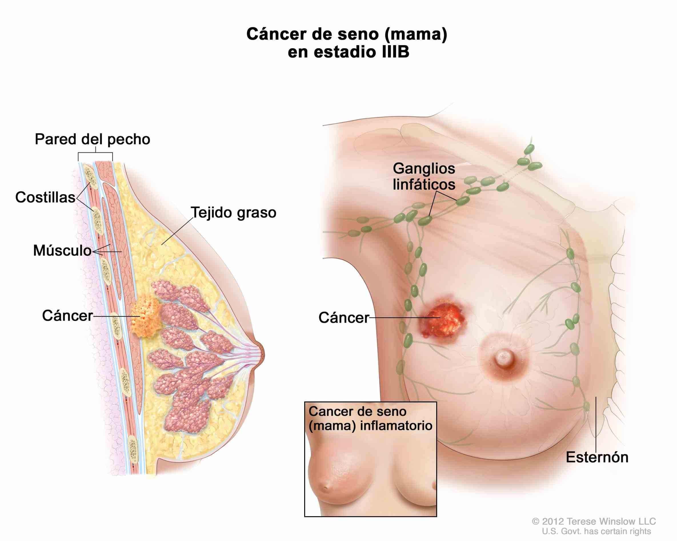 mama se origina cuando las células en comienzan a