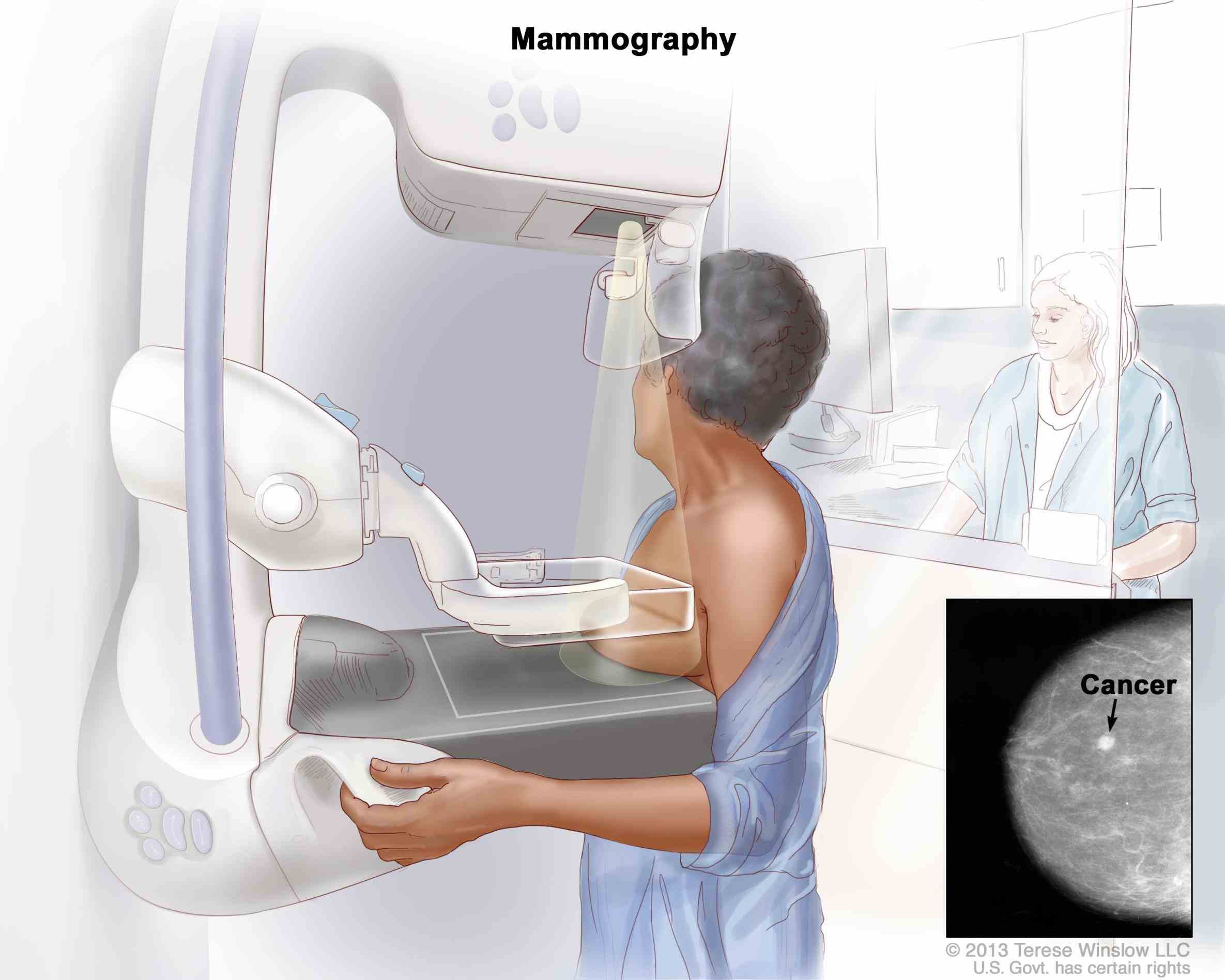 men Breast Cancer Screening For Men have much