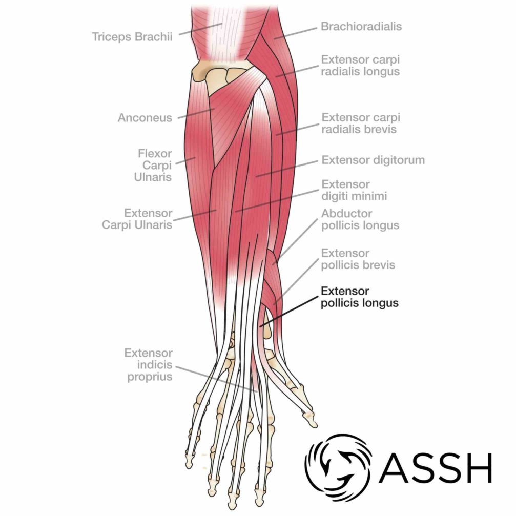 the Anatomy Of The Thumb Ligaments ligaments and pulleys of thumb show