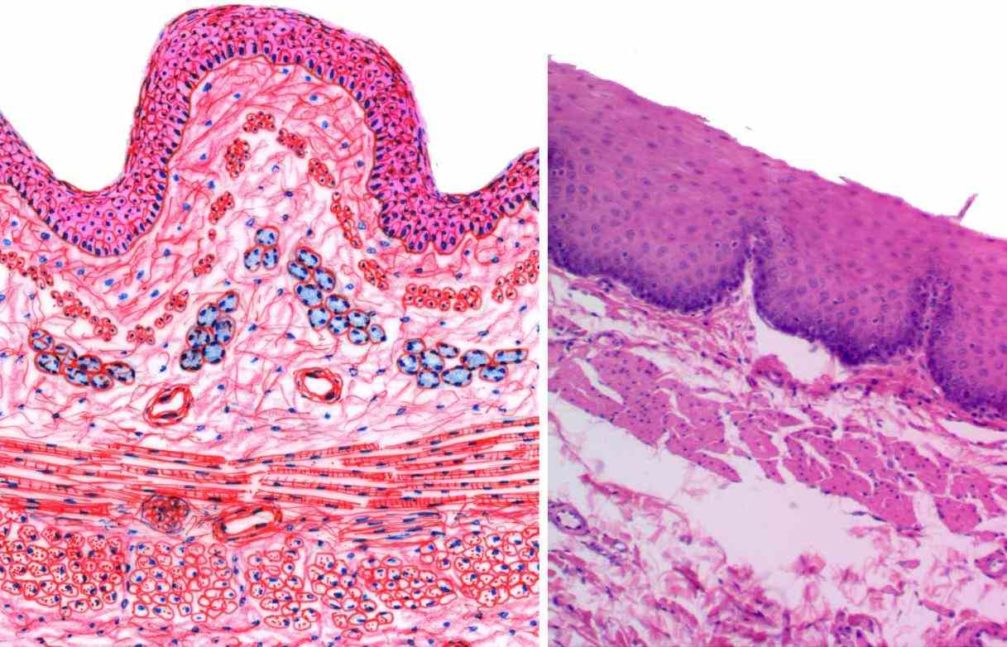 epithelium [example] link is external nonkeratinized stratified