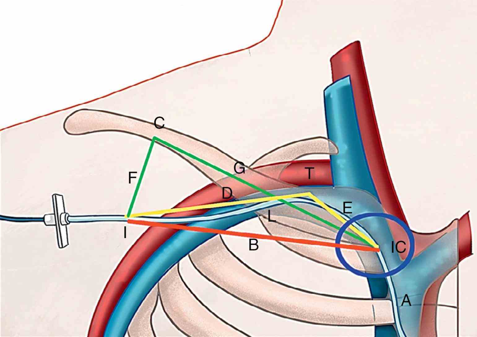 Arteria Subclavia Esquerda Gato Arteria Subclavia Esquerda Gato